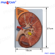 Nierenmodell PNT-0560cc mit Nebenniere, medizinisches Nieren-Anatomie-Modell